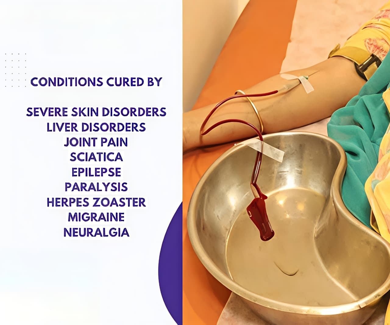 Blood Letting Therapy